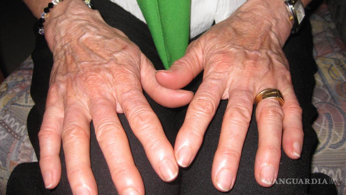 $!Temblor y lentitud de movimientos son algunos de los sintomas con los que se presenta la enfermedad de Parkinson.