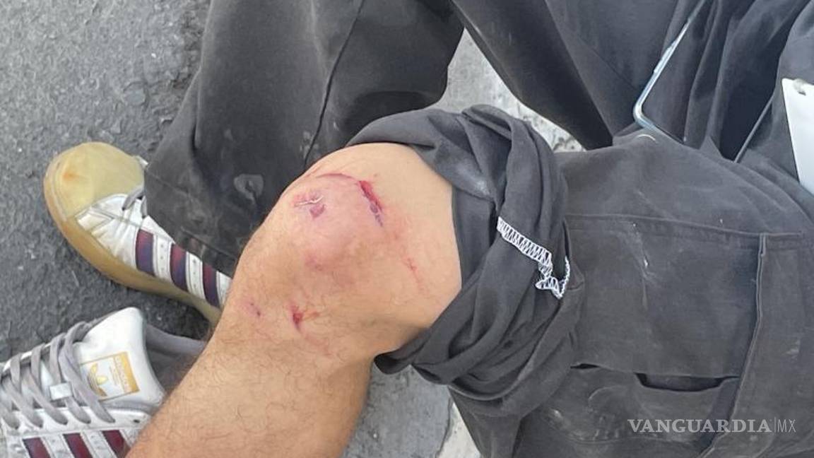 $!El joven motociclista, sufrió lesiones en su rodilla.