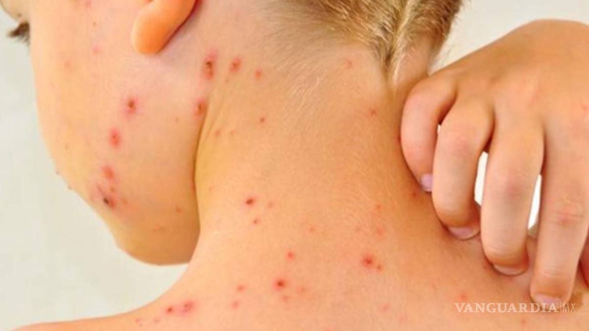 $!Personal médico acudió esta semana a la primaria de Huachichil para aplicar vacunas contra el sarampión, aunque no alcanzaron para todos los alumnos.