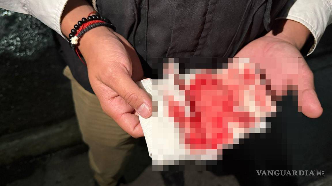 $!Se espera que el periodista afectado interponga su denuncia formal.