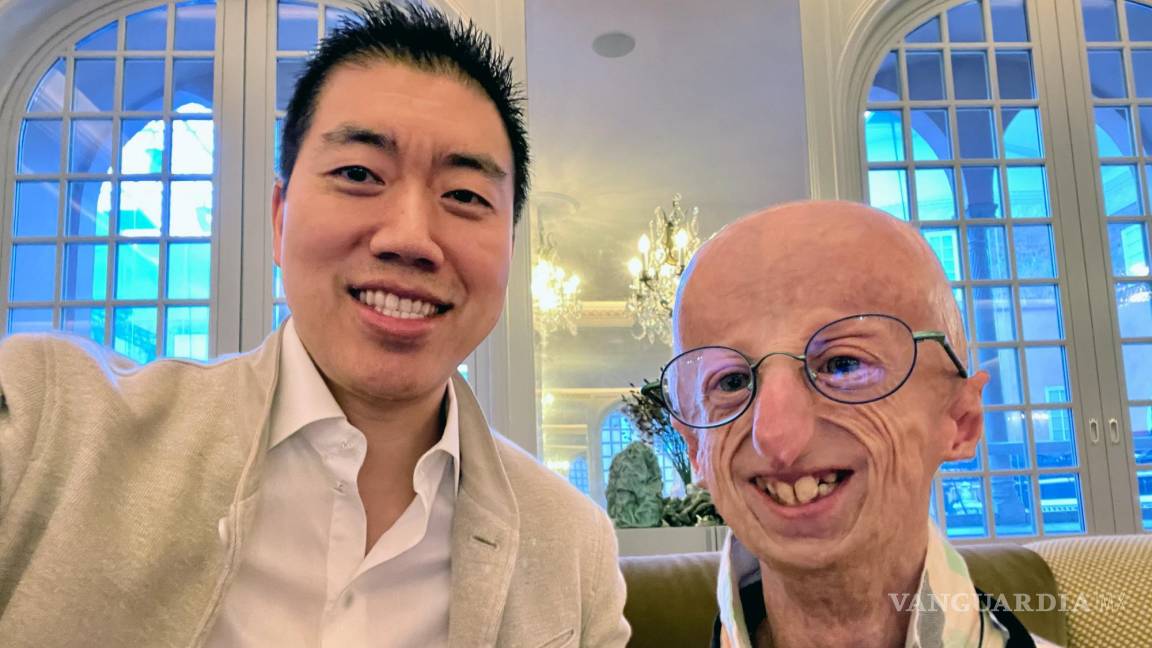 Progeria, una enfermedad rara que hace que los niños envejezcan rápido se acerca a la cura