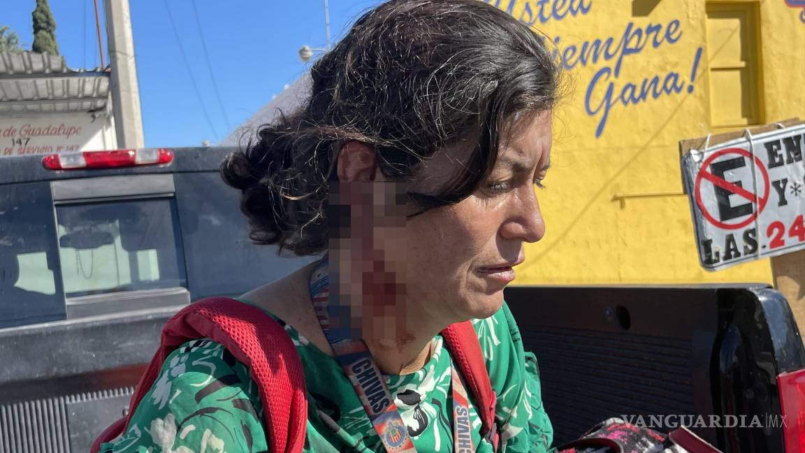 Presunto drogadicto lesiona a mujer a pedradas al no querer darle dinero en Saltillo