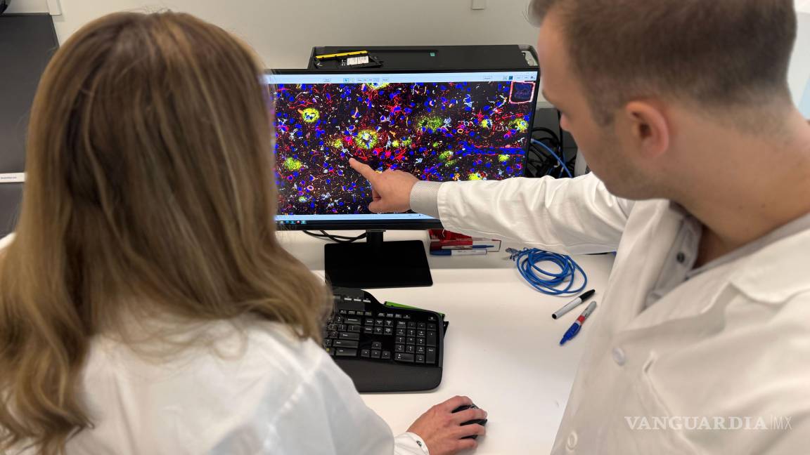 $!Los autores del estudio, David Gate (izquierda) y Lynn van Olst (derecha), examinan una imagen de computadora de un cerebro humano con enfermedad de Alzheimer que había sido tratado con inmunización contra la beta amiloide.