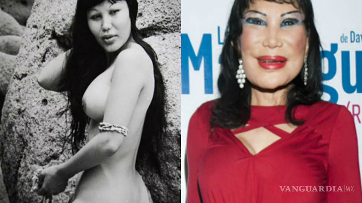 $!No solo es la Guzmán; estas celebridades quedaron peor con sus cirugías