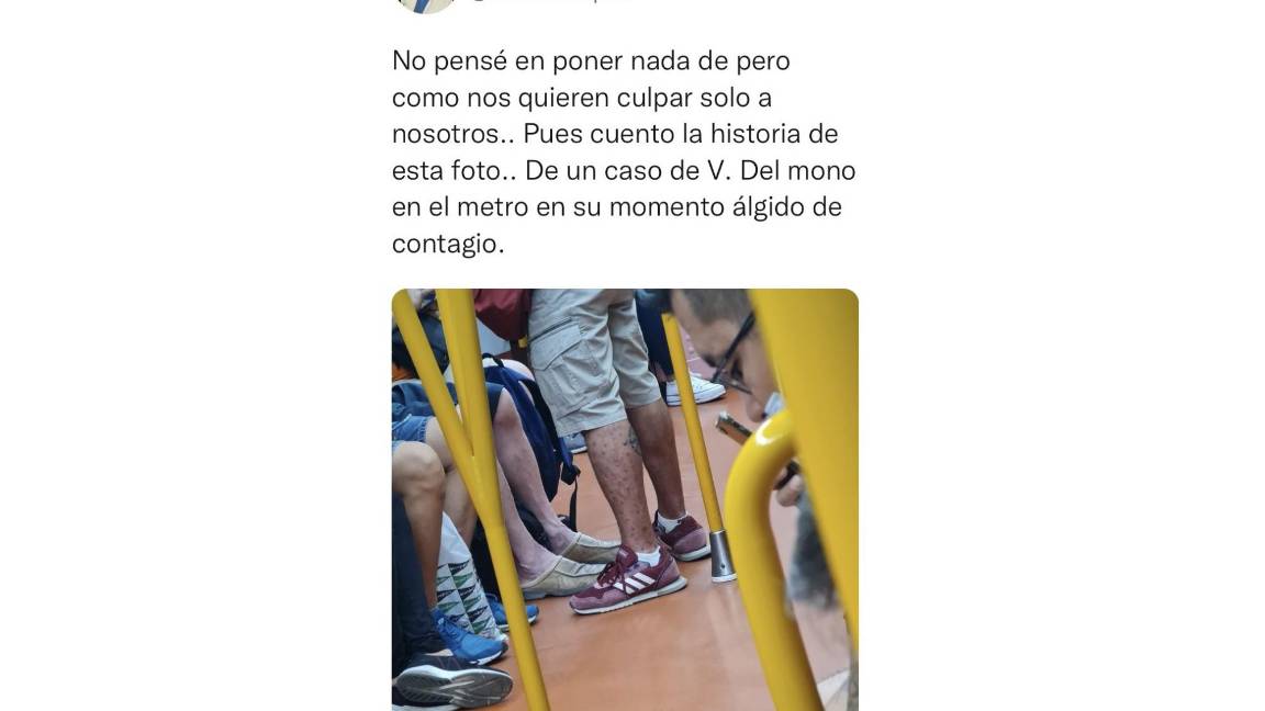 $!Un médico español reveló el caso del hombre infectado de viruela del mono que viajó por el Metro en dicho país