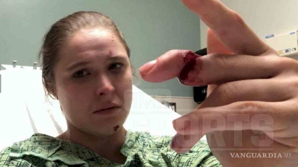 $!Ronda Rousey a punto de perder el dedo en México (foto)