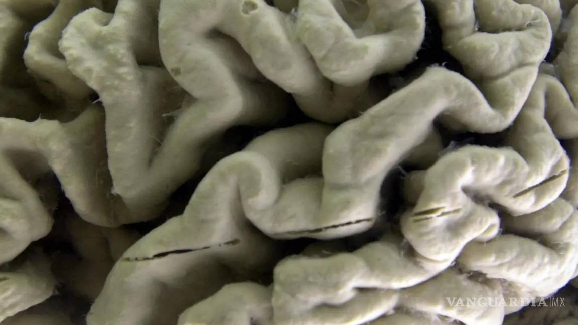 ¿Cómo un nuevo tipo de células del cerebro, ‘astrocitos glutamatérgicos’ ayudará a investigar el alzhéimer y el párkinson?