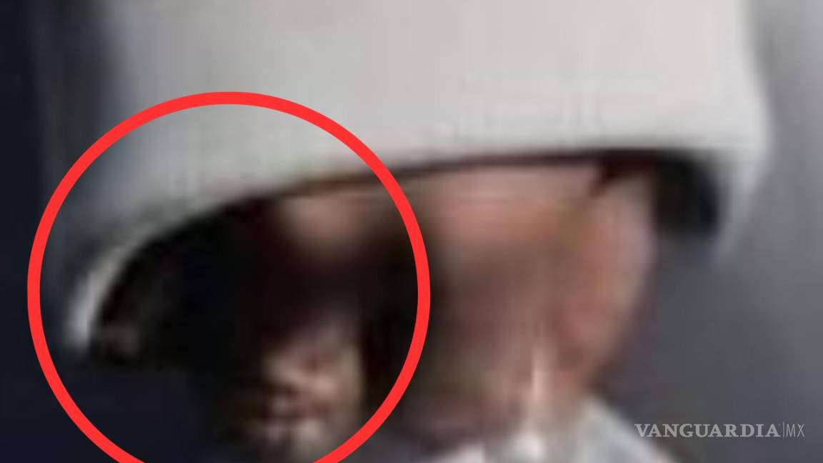 $!Se aprecia una dismorfia en su mano derecha. Parece que tiene un dedo menos.