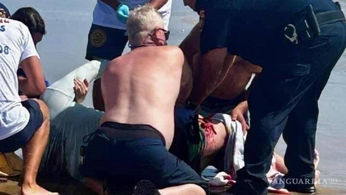 $!Serían cuatro las personas atacadas por un tiburón en la Isla del Padre