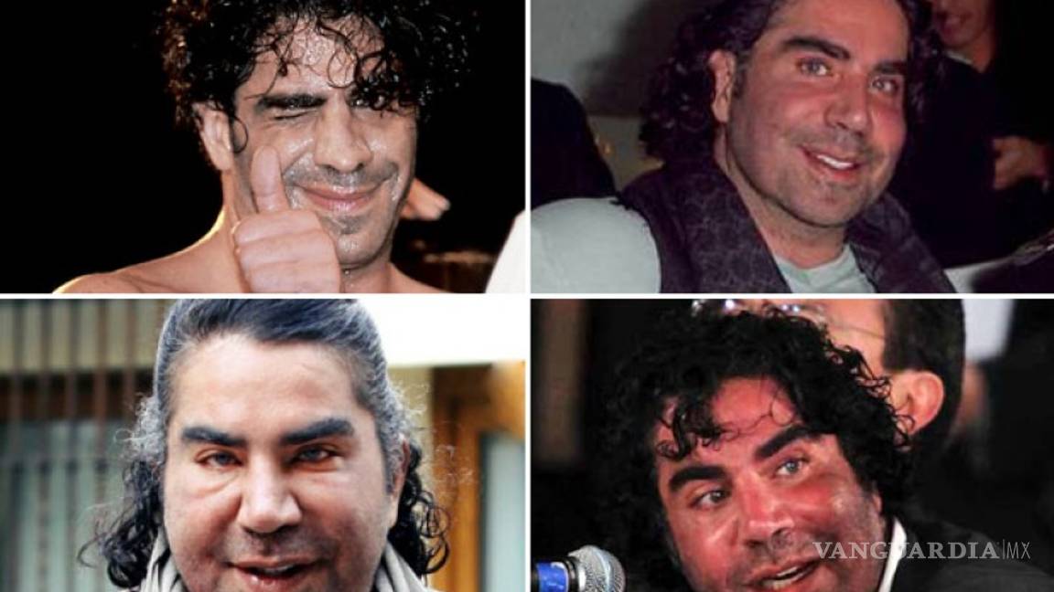 $!No solo es la Guzmán; estas celebridades quedaron peor con sus cirugías