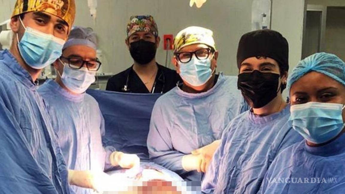 Retiraron tumor gigante de 21 kilos a derechohabiente del IMSS