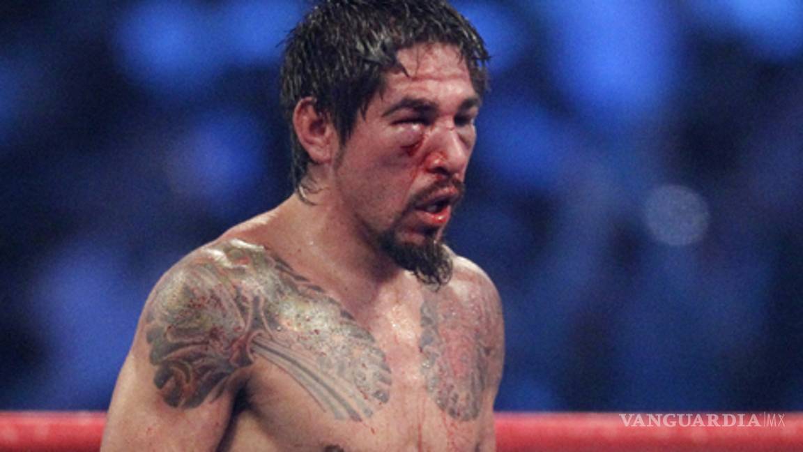 Margarito será operado del ojo tras la pelea ante Pacquiao