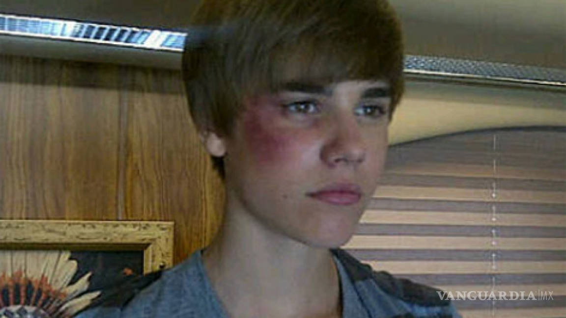 Justin Bieber, golpeado en fotografía