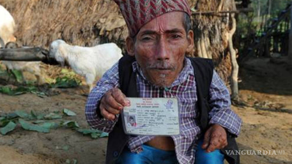 Nepalí dice ser el enano más pequeño del mundo