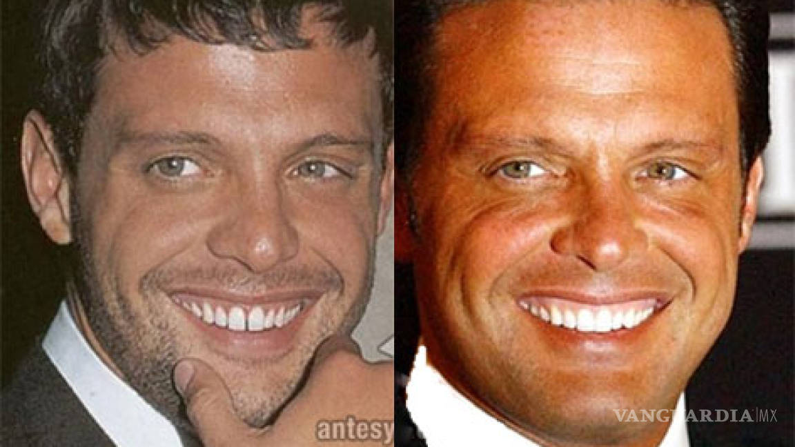 10 famosos que se arreglaron los dientes