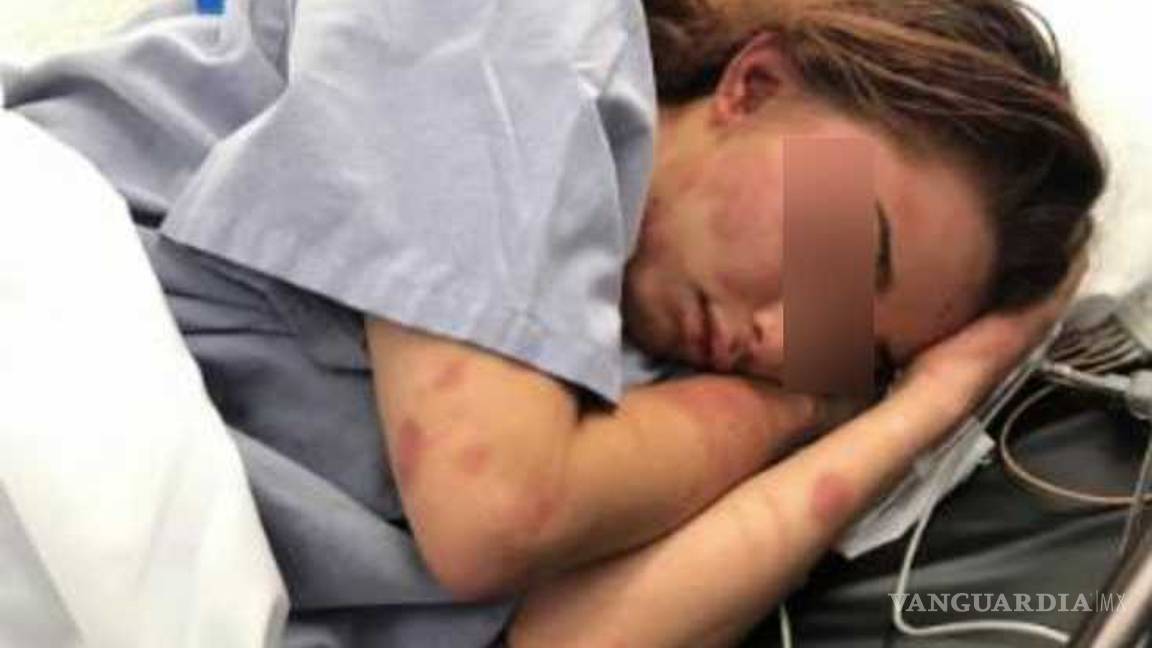 $!'Una hora golpeándola no implica que quería matarla'... karateca que dio golpiza a su novia quedaría en libertad gracias a jueces