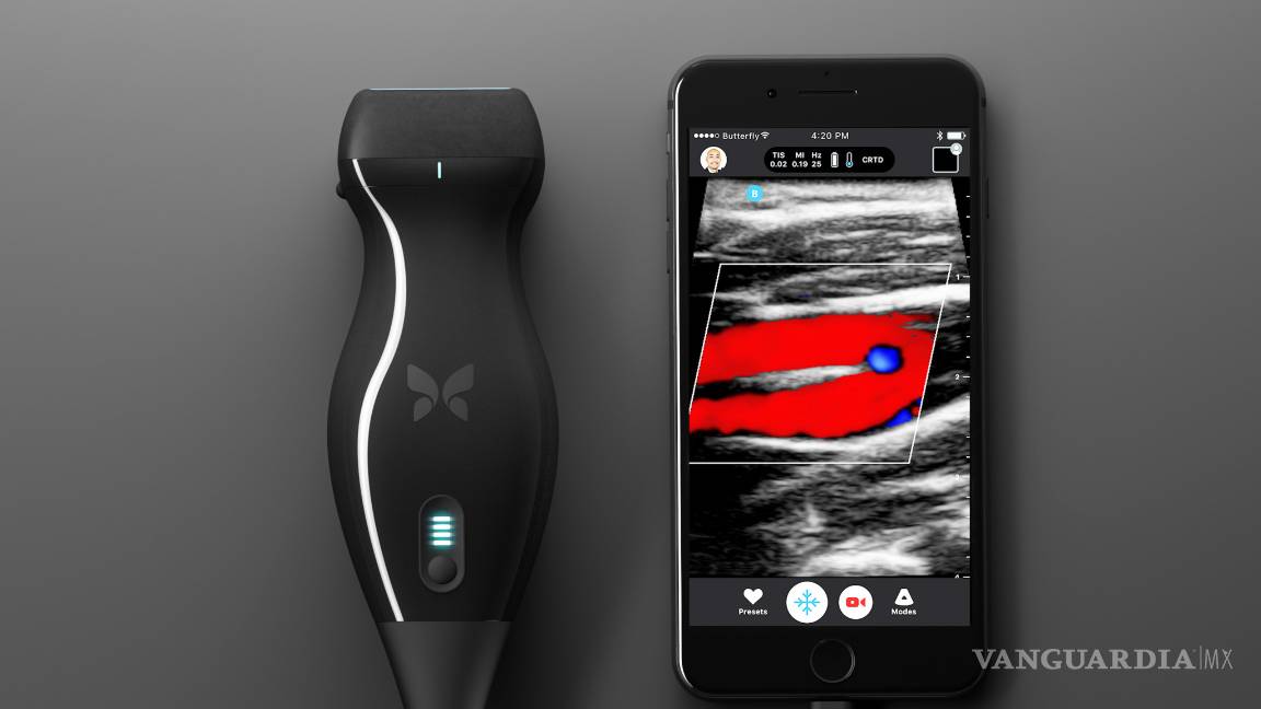 $!Con Butterfly iQ ya puedes ver tus ecografías desde tu celular