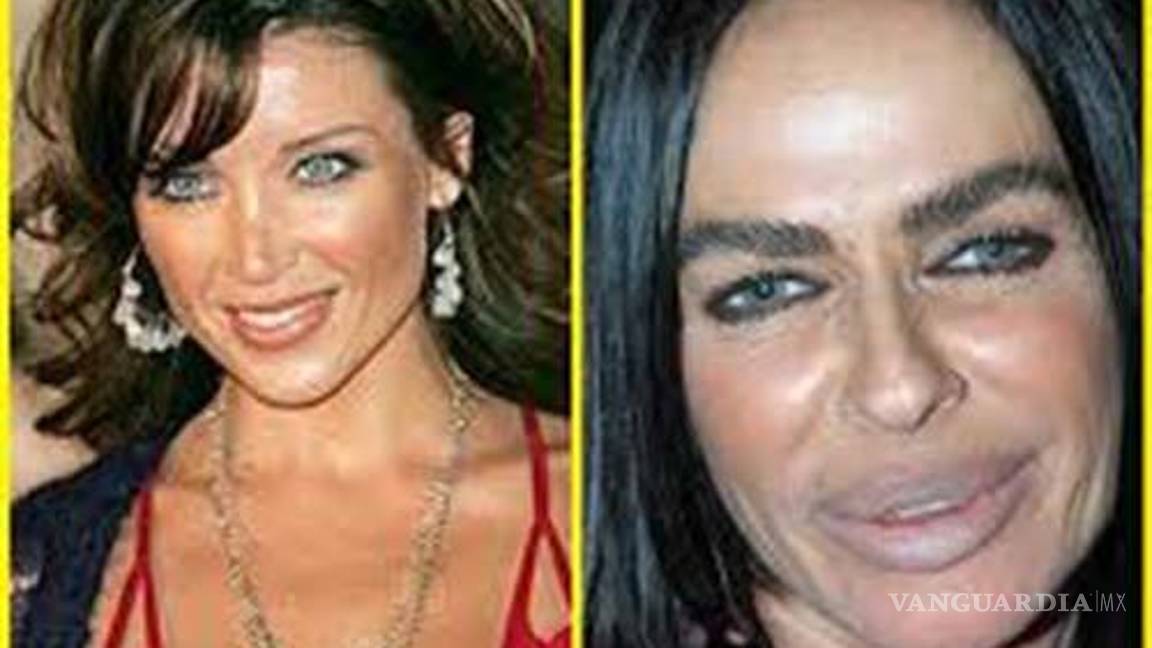 $!¿Una cirugía más? Axl Rose y Mickey Rourke lucen irreconocibles