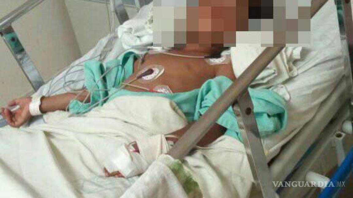 En Monclova, niño de 5 años con graves lesiones tras ser embestido por un caballo; jinete huyó del lugar