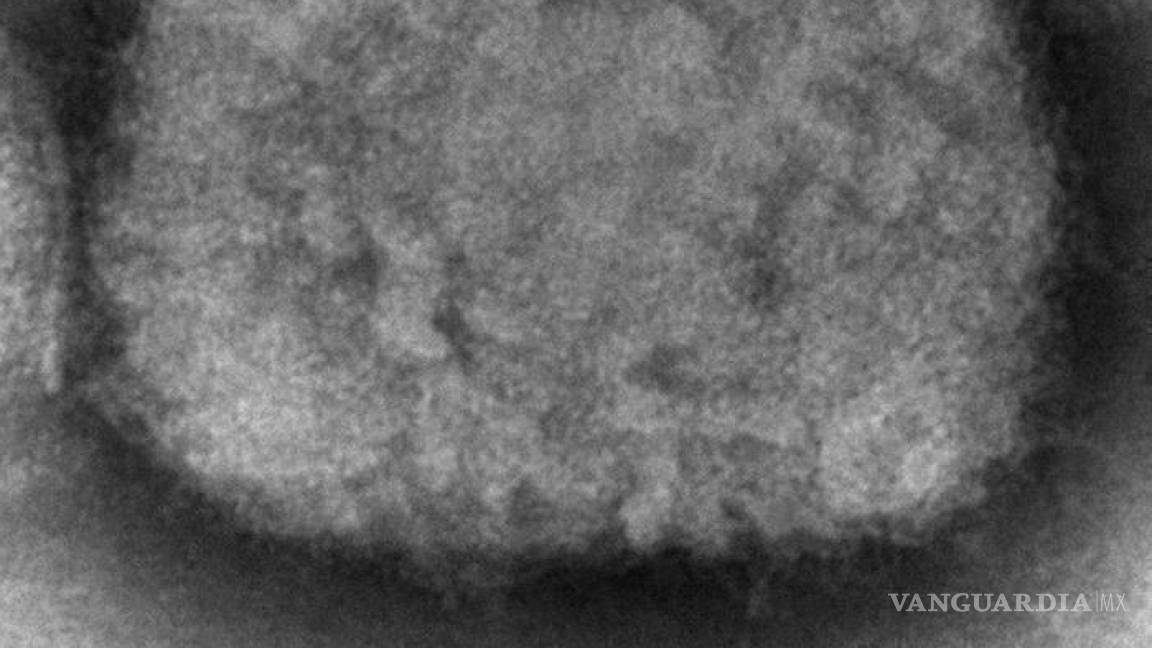 $!Esta imagen de microscopio de 2003 que muestra un virión del virus de la viruela símica o del mono obtenido de una muestra relacionada con un brote en perros.