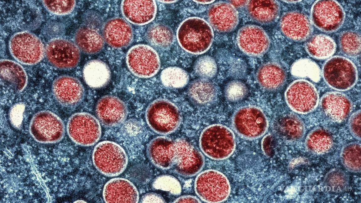 OMS decide cambiar el nombre de la viruela símica a mpox