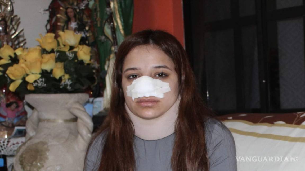 Denuncian a ex policía de Saltillo por violentar a su pareja; agresor huye