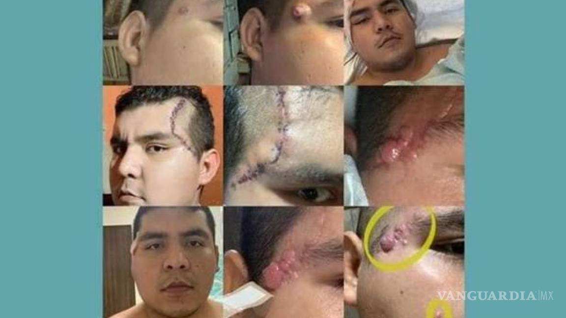 $!Alonso no dejó de pelear nunca por su vida, dejó un gran ejemplo en quienes lo conocieron.