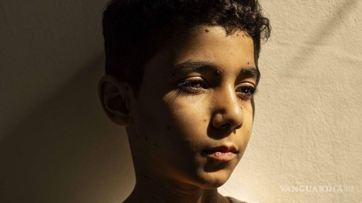 $!En la imagen Mahmoud Ajjour, de la fotógrafa palestina Samar Abu Elouf para The New York Times.