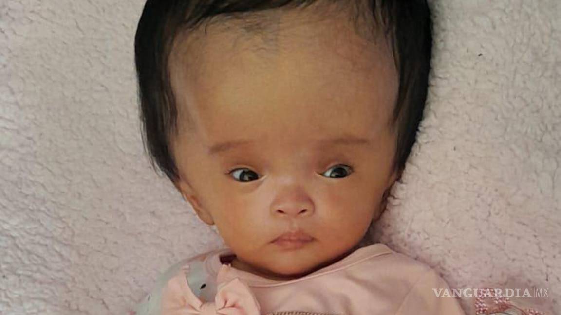 Familia en Saltillo solicita apoyo para bebé con hidrocefalia congénita