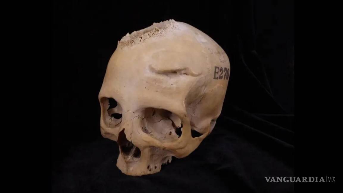 $!El cráneo E270, que data de entre 663 y 343 a. C., pertenecía a una mujer mayor de 50 años.
