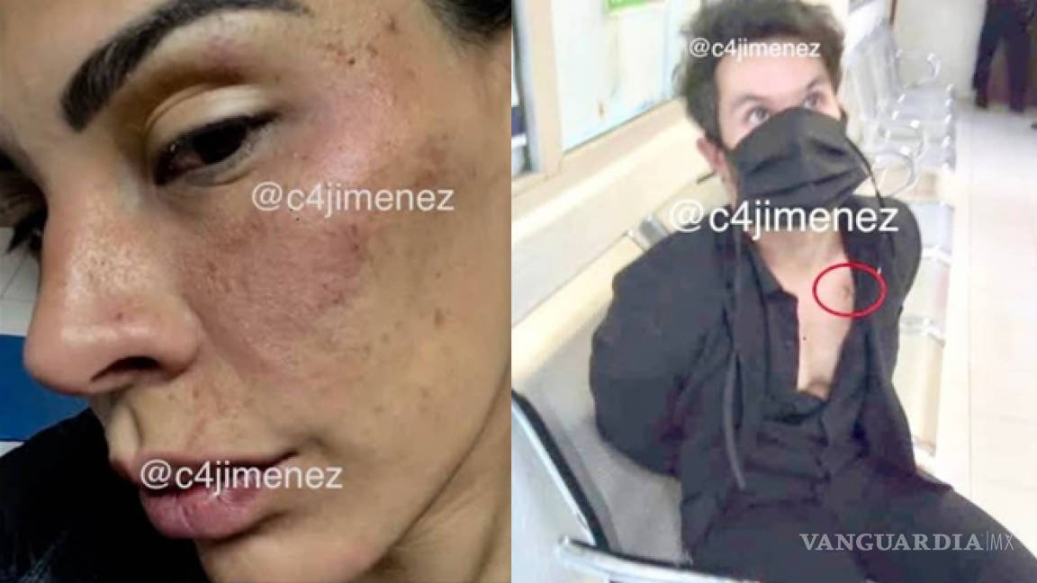 Revelan los golpes que presuntamente Eleazar Gómez le propinó a su novia Stephanie Valenzuela (fotos)