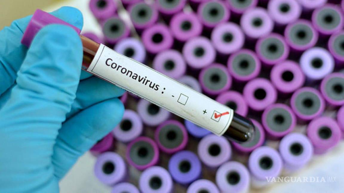 Científicos británicos buscan voluntarios para ser contagiados con coronavirus; les pagarán 4 mil 500 dólares