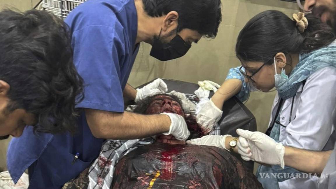 $!En esta foto distribuida por Inter Services Public Relations, una mujer herida por un presunto ataque de India con misiles recibe tratamiento en un hospital de Bahawalpur, Pakistán, el 7 de mayo de 2025.