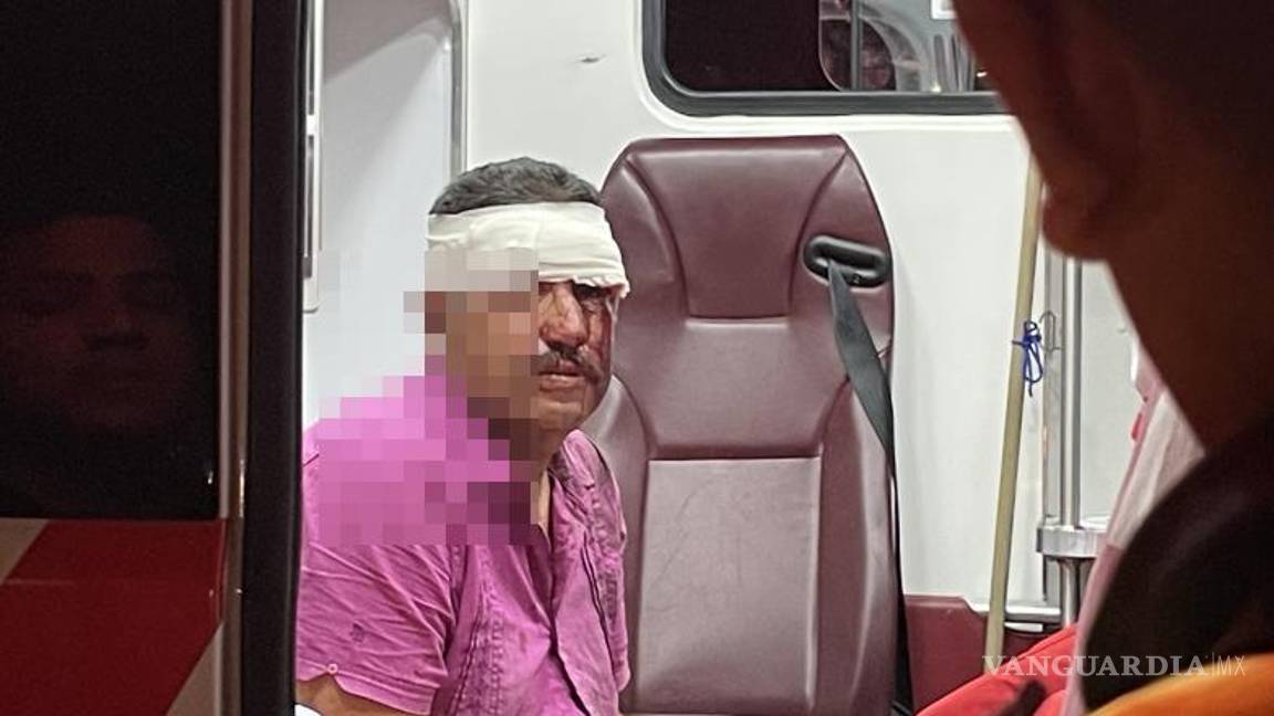 $!El choque ocurrió a la altura de la colonia Topochico; la motocicleta quedó parcialmente dañada.