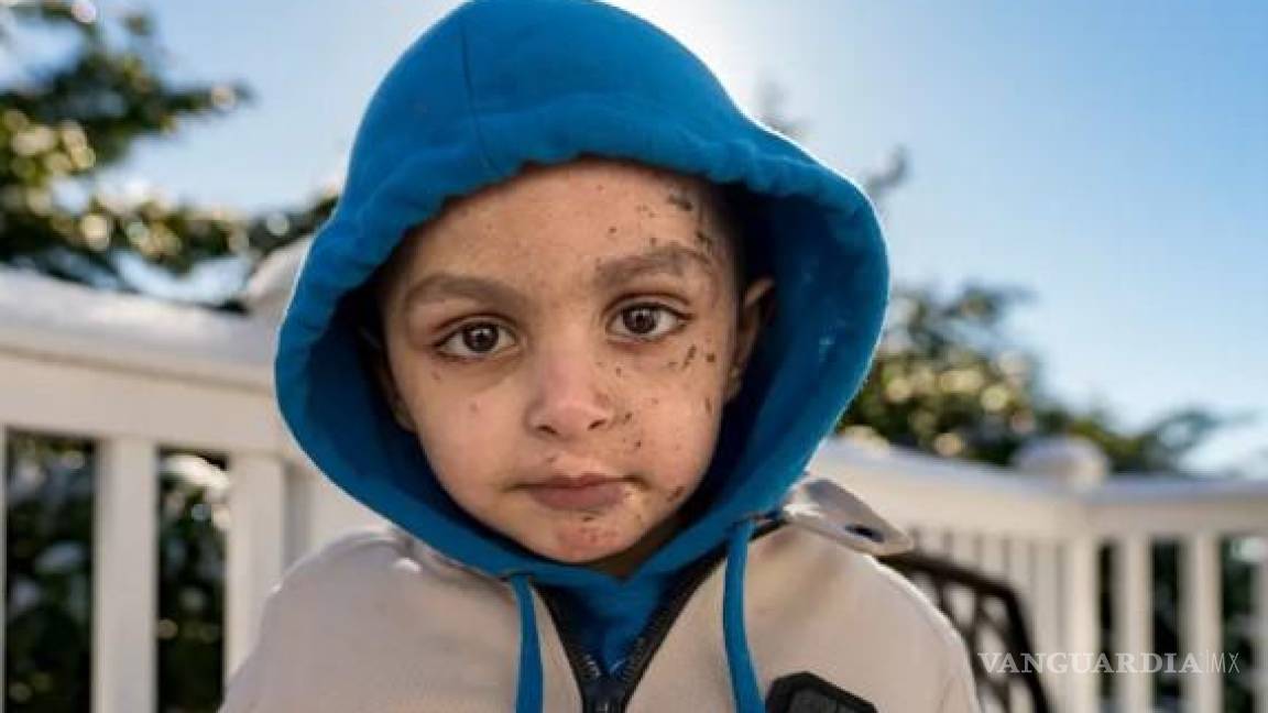 La conmovedora historia del niño de cuatro años de Gaza que perdió su brazo y a sus padres en un ataque aéreo israelí