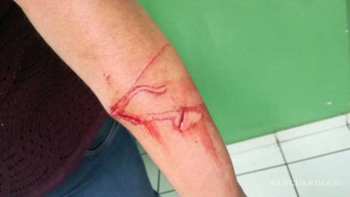 Menor de 10 años de edad agrede con cuchillo a su profesora en Jalisco
