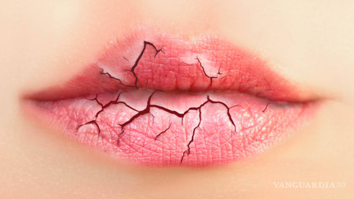 12 razones por las que se resecan tus labios y cómo prevenirlo