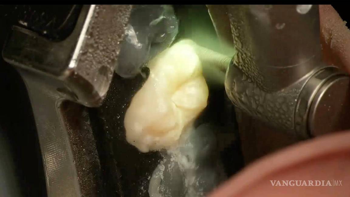 $!Primer plano de intervención robótica en un maniquí.