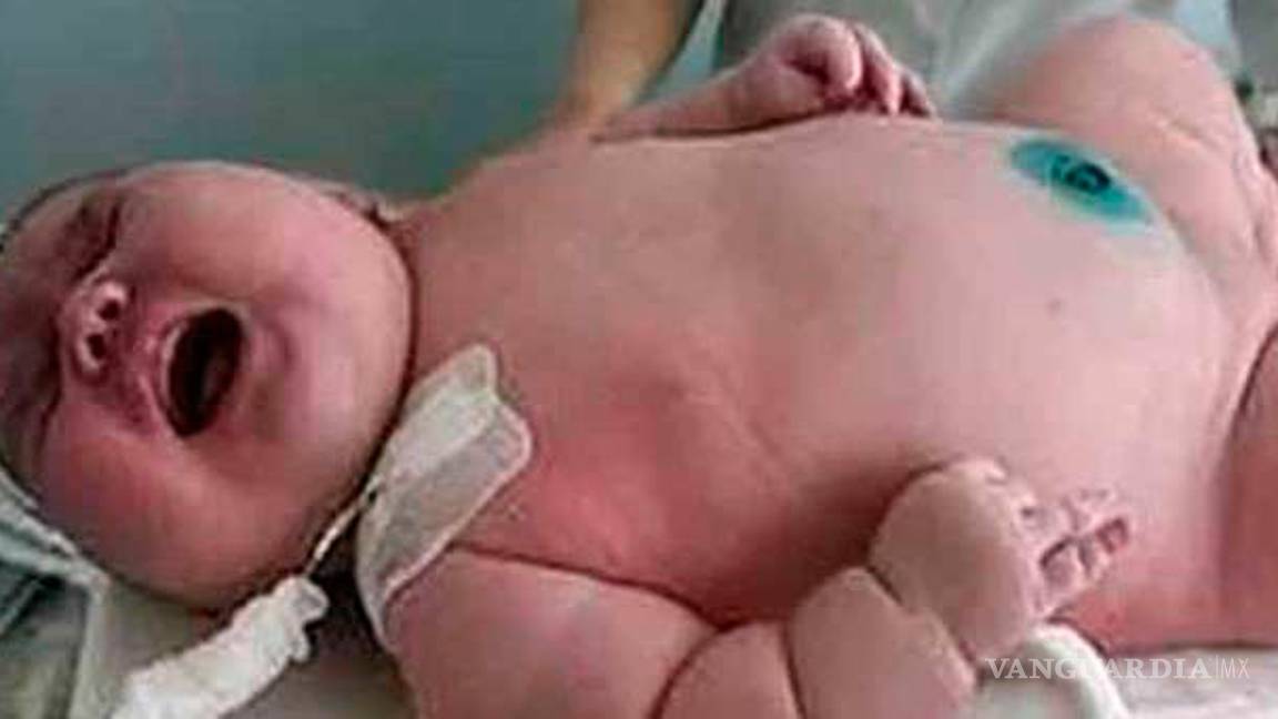 $!Mujer de 272 kilos da a luz a un bebé de 18 kilos, es el más grande de la historia