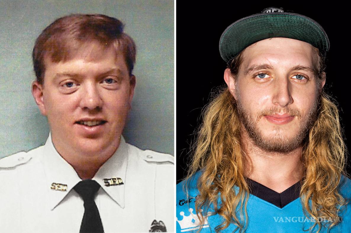 $!Realizan con éxito el trasplante de cara más completo del mundo