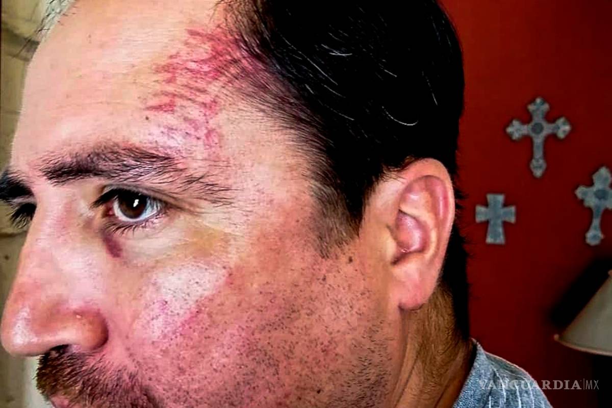 Interponen denuncia contra dueño del bar Polanquito de Saltillo