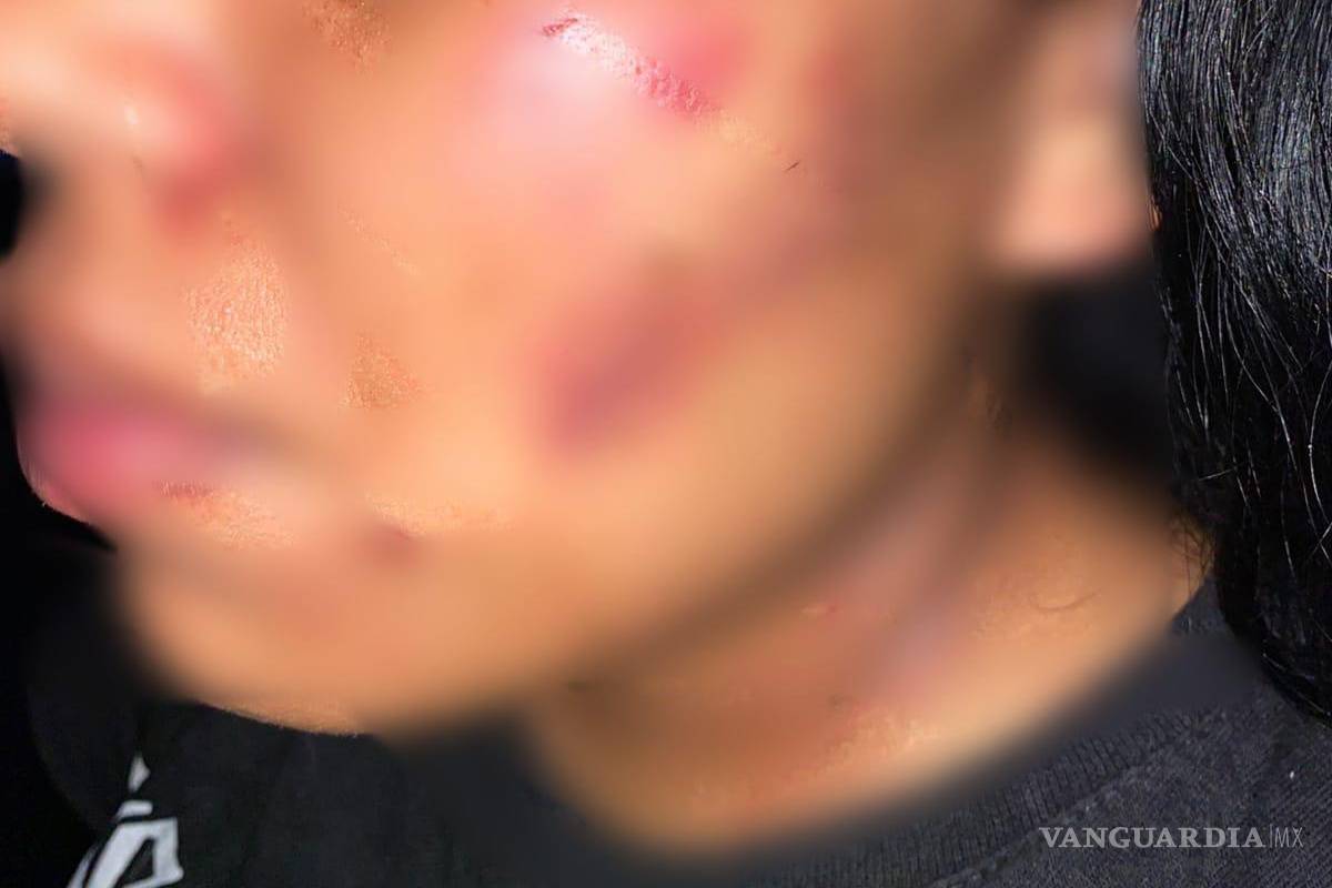 Nuevo León: Policías de Guadalupe evitan feminicidio y arrestan a agresor