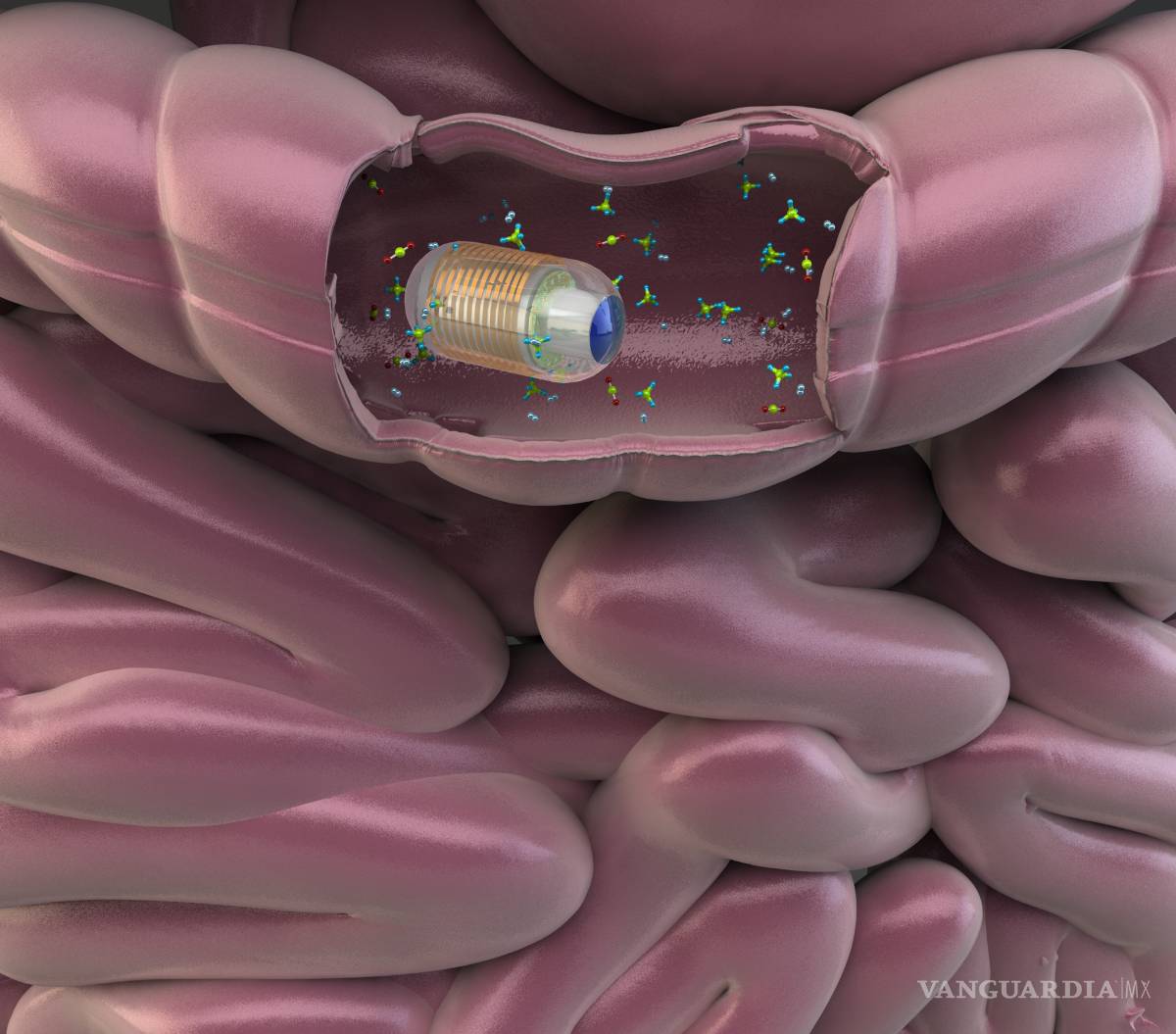 $!Cápsulas endoscópica, la nueva ‘espía’ intestinal