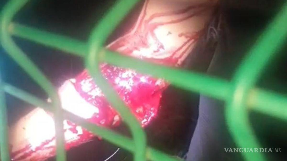 Ladrón termina herido tras asaltar a taxista en Saltillo
