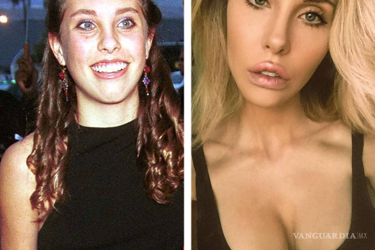 Pese a lucir súper sexy, hija de Olivia Newton-John se arrepiente de las cirugías (fotos)