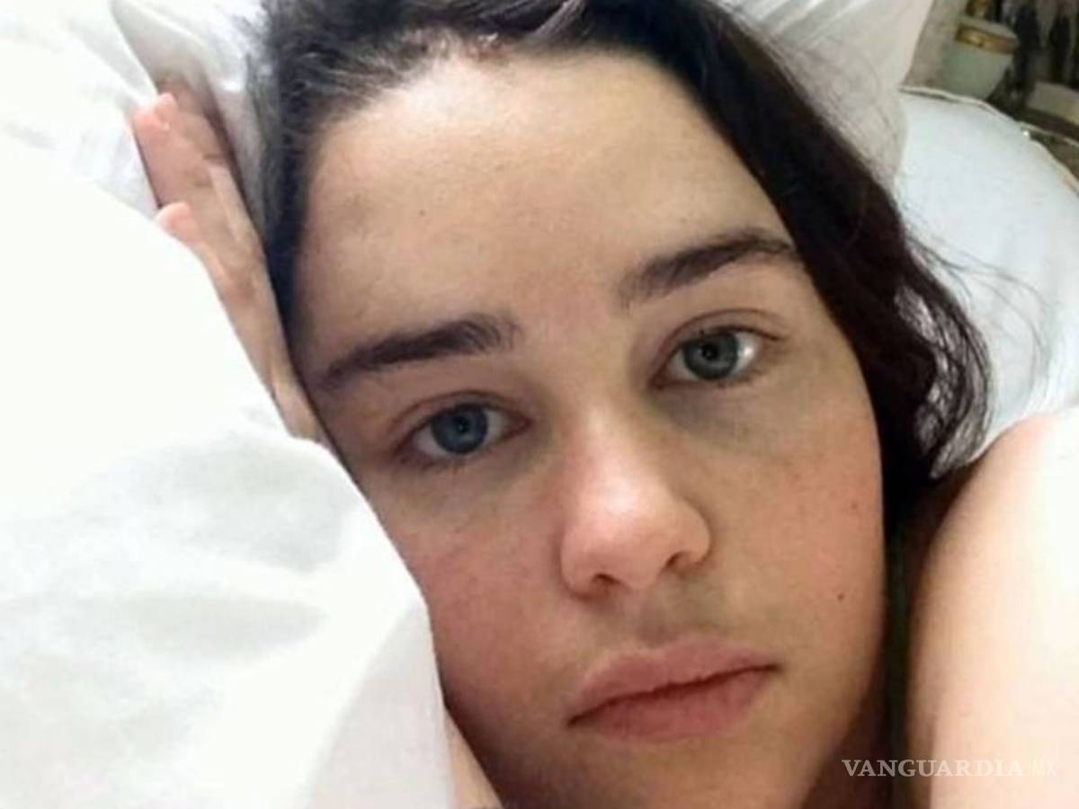 $!Emilia Clarke de Game of Thrones casi pierde la vida y compartió fotos del suceso