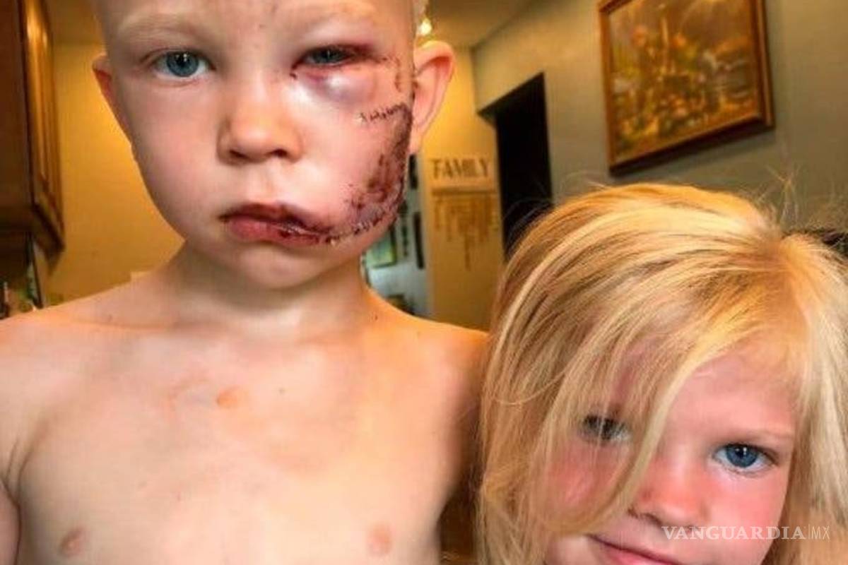 Avengers mandan emotivos mensajes a niño superhéroe que salvó a su hermana del ataque de un perro (videos)