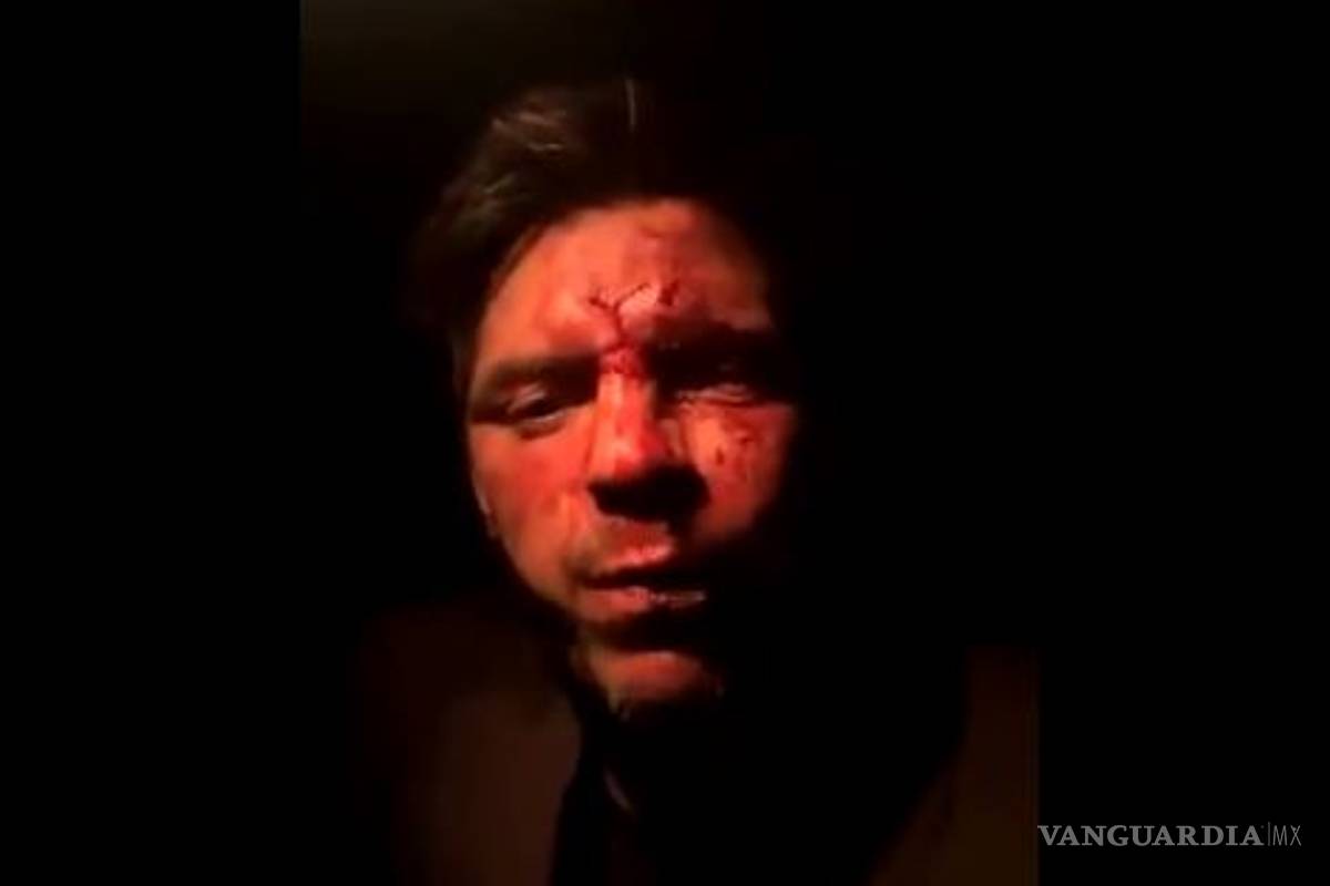 Hijo de Lupita D'Alessio acusa de brutal golpiza a familia de Arturo Montiel