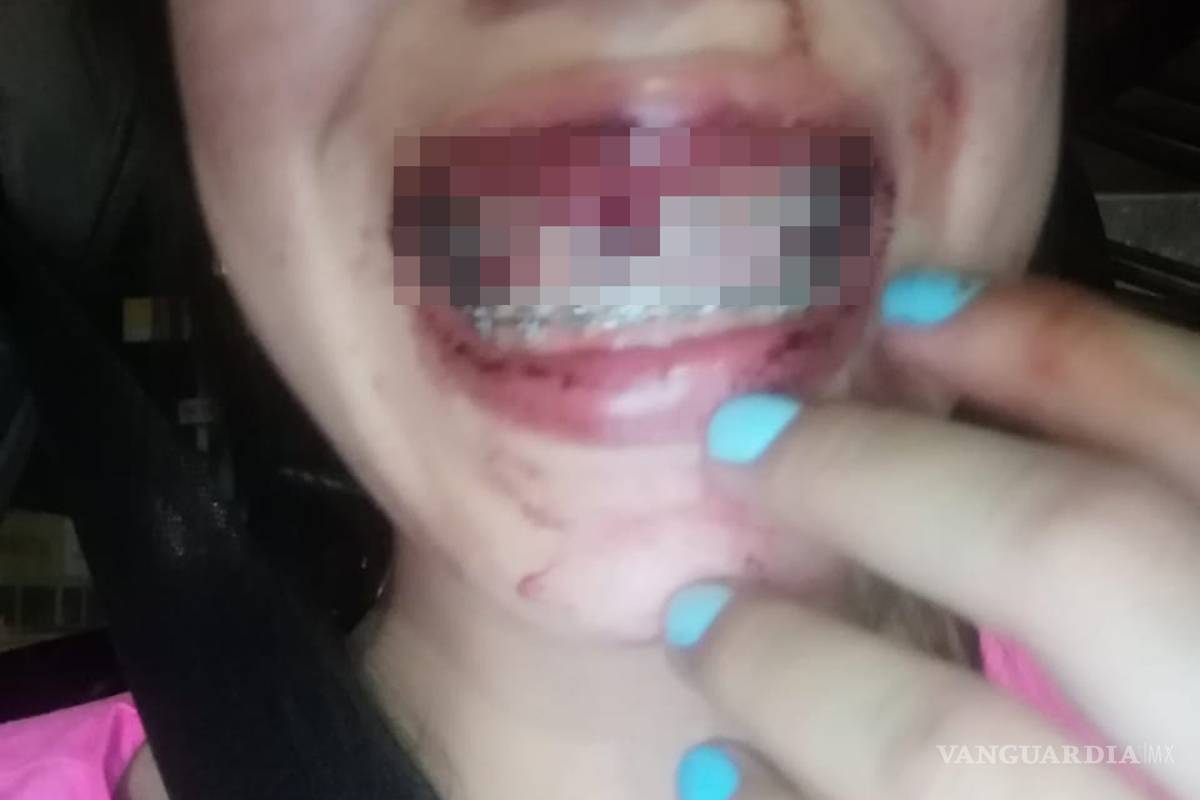 Se viraliza en redes agresión contra mujer saltillense; le tumba los dientes ex pareja