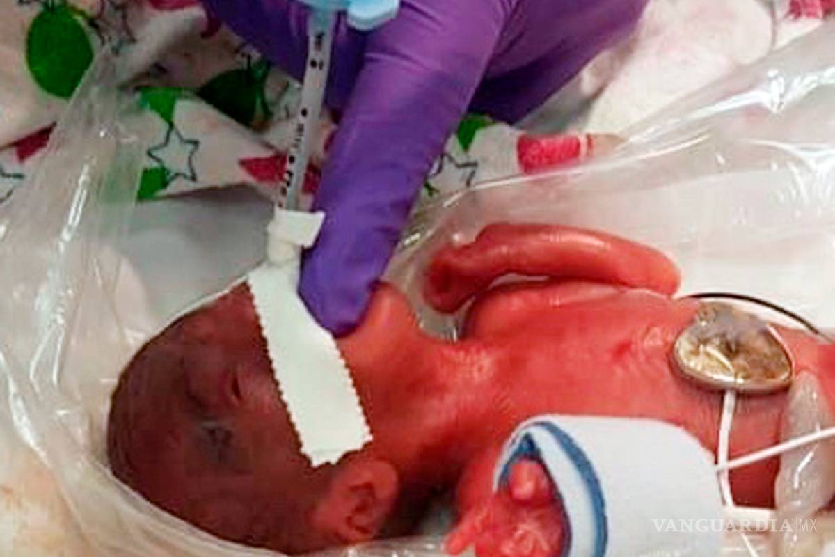 Ella es Saybie, la bebé más pequeña del mundo de apenas 245 gramos que logra sobrevivir